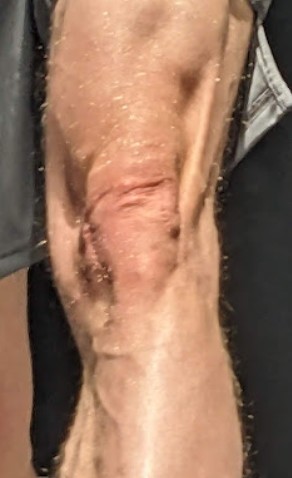 Knie rechts.jpg