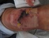 knie.jpg