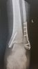 20170208_083907.jpg
