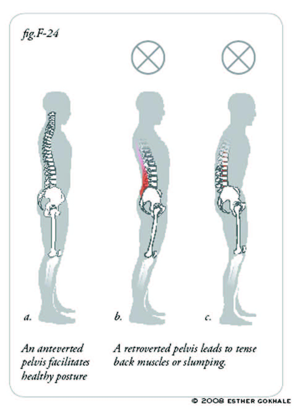 68_Perfecting_Posture_for_Injury_Prevention.jpg